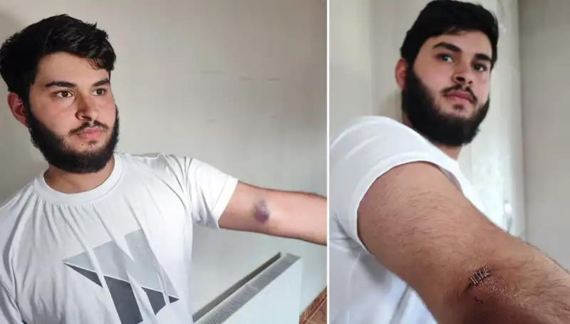 Bahçeye Kaçan Top, Mahallede Hızla Yaygınlaşan 'Conolar' İle Karıştı!