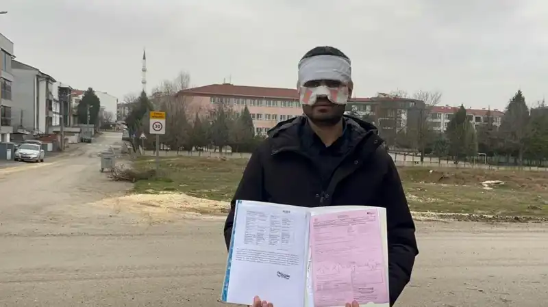 Öğretmen Krizi: Sıcak Çayla Yüzüne Fırlatılan Meslektaş dehşeti!